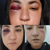«Si me mata, al menos intenté frenarlo»: El desesperado grito de ayuda de una mujer agredida